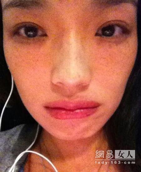 明星雀斑图片